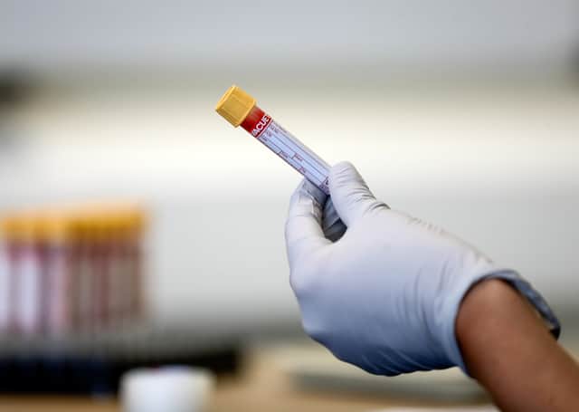 So far, more than 4000 antibody tests have been carried out in Scotland for surveillance purposes. Photo by Simon Dawson - Pool/Getty Images.