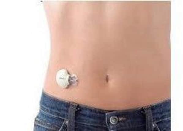 Pictured is the continuous glucose monitoring sensor.