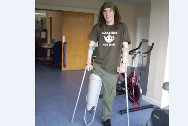Andy lost his right leg below the knee almost seven years ago.